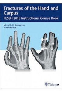 Fractures Of The Hand And Carpus "FESSH 2018 Instructional Course Book"