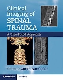 Clinical Imaging of Spinal Trauma "A Case-Based Approach"
