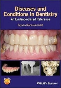 Diseases and Conditions in Dentistry "An Evidence-Based Reference"