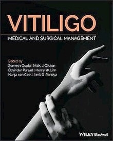 Vitiligo "Medical and Surgical Management"