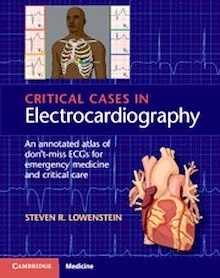 Critical Cases in Electrocardiography "An Annotated Atlas of Don't-Miss ECGs for Emergency and Critical Care"
