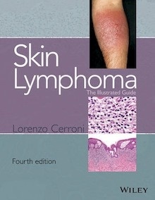 Skin Lymphoma "The Illustrated Guide"