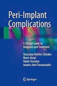Peri-Implant Complications "A Clinical Guide to Diagnosis and Treatment"