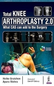 Total Knee Arthroplasty 2.0 "What CAS Can Add to the Surgery + CD-ROM"