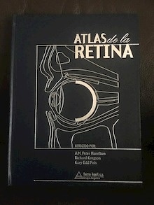 Atlas de la Retina