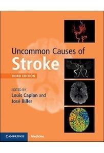 Uncommon Causes Of Stroke
