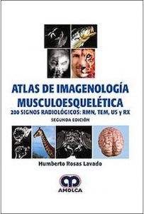 Atlas de Imagenología Musculoesquelética "200 Signos Radiológicos: Rmn  Tem  Us y Rx"