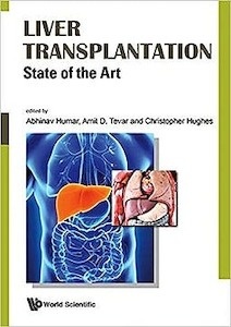 Liver Transplantation "State of the Art"