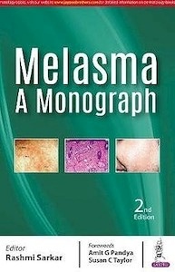Melasma. A Monograph