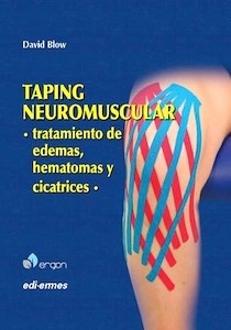 Taping Neuromuscular. Tratamiento de Edemas, Hematomas y Cicatrices