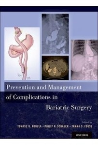 Prevention And Management Of Complications In Bariatric Surgery