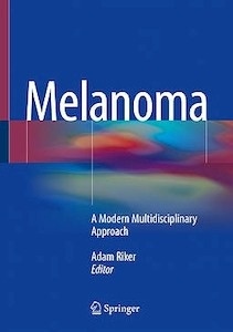 Melanoma "A Modern Multidisciplinary Approach"
