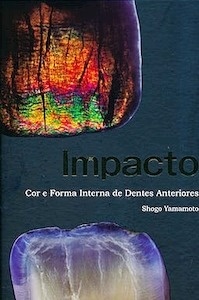 Impacto "Color y Forma Interna de Dientes Anteriores (Edición Bilingüe Español-Portugués)"