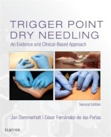 Trigger Point Dry Needling