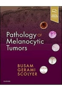 Pathology Of Melanocytic Tumors