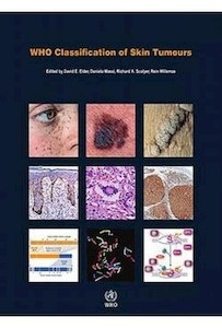 WHO Classification Of Skin Tumours