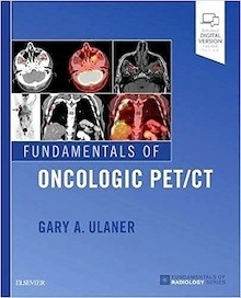 Fundamentals of Oncologic PET/CT (Print and Online)