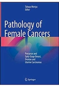 Pathology Of Female Cancers "Precursor And Early-Stage Breast  Ovarian And Uterine Carcinomas"