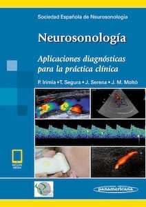 Neurosonología (incluye eBook) "Aplicaciones diagnósticas para la práctica clínica"