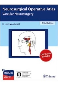Neurosurgical Operative Atlas "Vascular Neurosurgery"