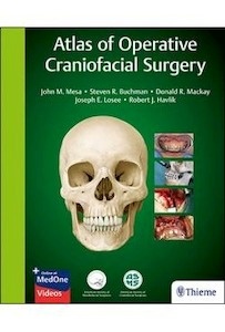 Atlas Of Operative Craniofacial Surgery