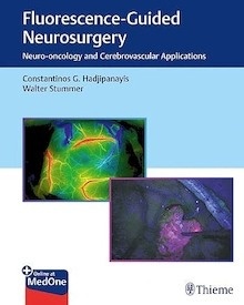 Fluorescence-Guided Neurosurgery "Neuro-Oncology and Cerebrovascular Applications"