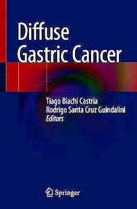 Diffuse Gastric Cancer