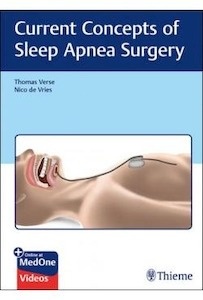 Current Concepts Of Sleep Apnea Surgery