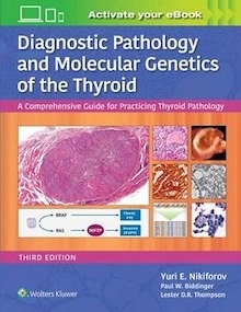 Diagnostic Pathology and Molecular Genetics of the Thyroid "A Comprehensive Guide for Practicing Thyroid Pathology"