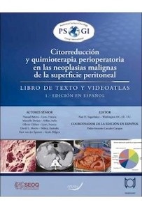 Citorreducción y Quimioterapia Perioperatoria en las Neoplasias Malignas de la Superficie Peritoneal