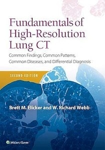 Fundamentals of High-Resolution Lung CT "Common Findings, Common Patterns, Common Diseases and Differential Diagnosis"