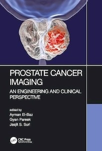 Prostate Cancer Imaging "An Engineering and Clinical Perspective"