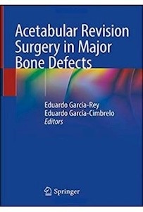 Acetabular Revision Surgery In Major Bone Defects