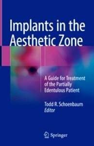 Implants in the Aesthetic Zone "A Guide for Treatment of the Partially Edentulous Patient"