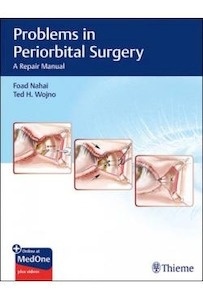 Problems In Periorbital Surgery "A Repair Manual"
