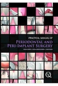 Practical Manual Of Periodontal And Peri-Implant Surgery