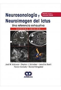 Neurosonología y Neuroimagen del Ictus "Una Referencia Exhaustiva"