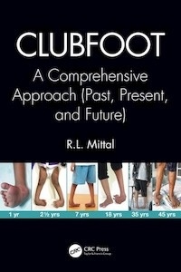 Clubfoot: A Comprehensive Approach "(Past, Present, and Future)"