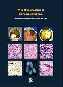 WHO Classification Of Tumours Of The Eye