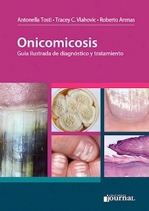 Onicomicosis "Guía Ilustrada de Diagnóstico y Tratamiento"