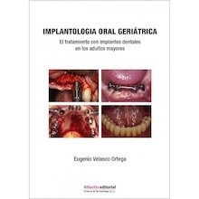 Implantología Oral Geriátrica "El Tratamiento con Implantes Dentales en los Adultos Mayores"