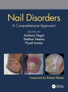 Nail Disorders "A Comprehensive Approach"