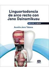 Linguortodoncia de Arco Recto con Jano Dainamikusu