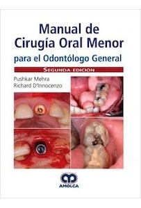 Manual de Cirugía Oral Menor para el Odontólogo General