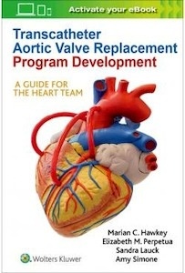 Transcatheter Aortic Valve Replacement Program Development "A Guide For The Heart Team"