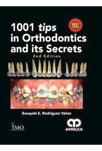 1001 Tips In Orthodontics And Its Secrets