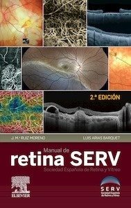 Manual de Retina SERV