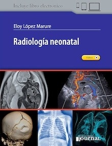 Radiología Neonatal (Incluye Libro Electrónico)