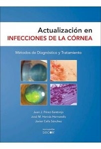 Actualización en Infecciones de la Cornea "Métodos de Diagnóstico y Tratamiento"