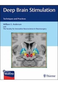Deep Brain Stimulation "Techniques And Practices"